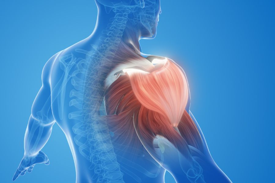 Ασβεστοποιός Τενοντίτιδα Ώμου: Διατροφή για Αντιμετώπιση